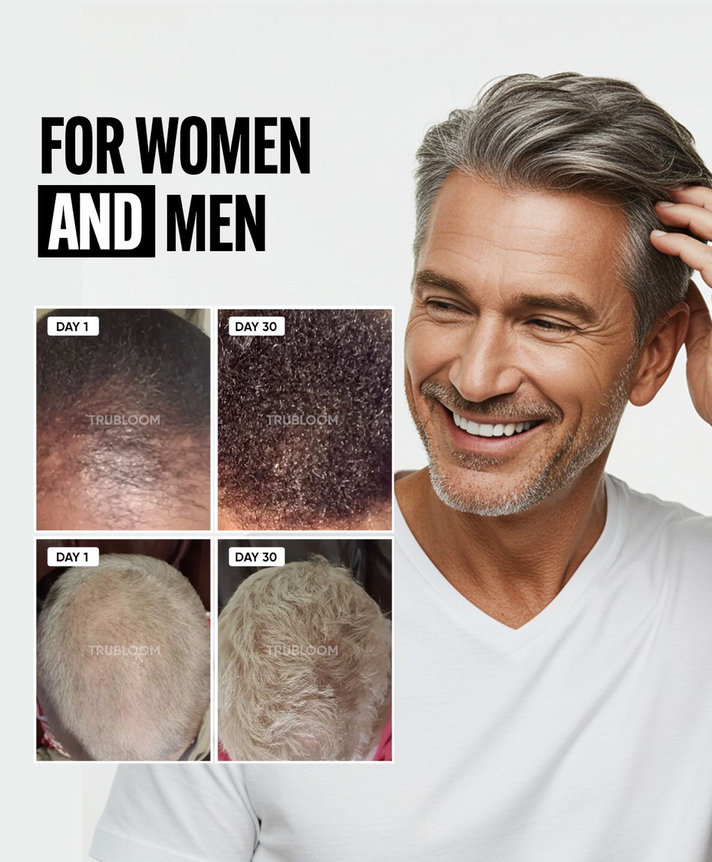 TRU BLOOM Hair Growth Vitamins - 1 Month Supply