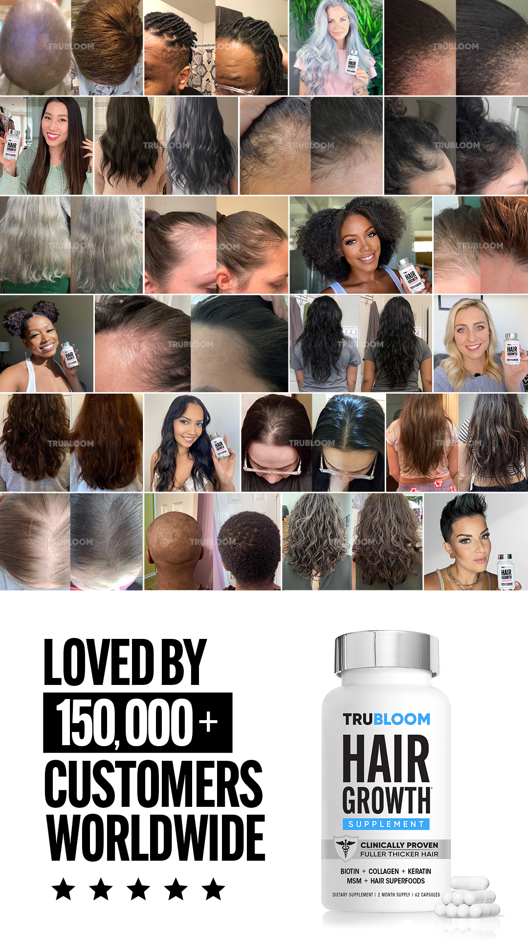 ST.Tropica Hair Vitamins