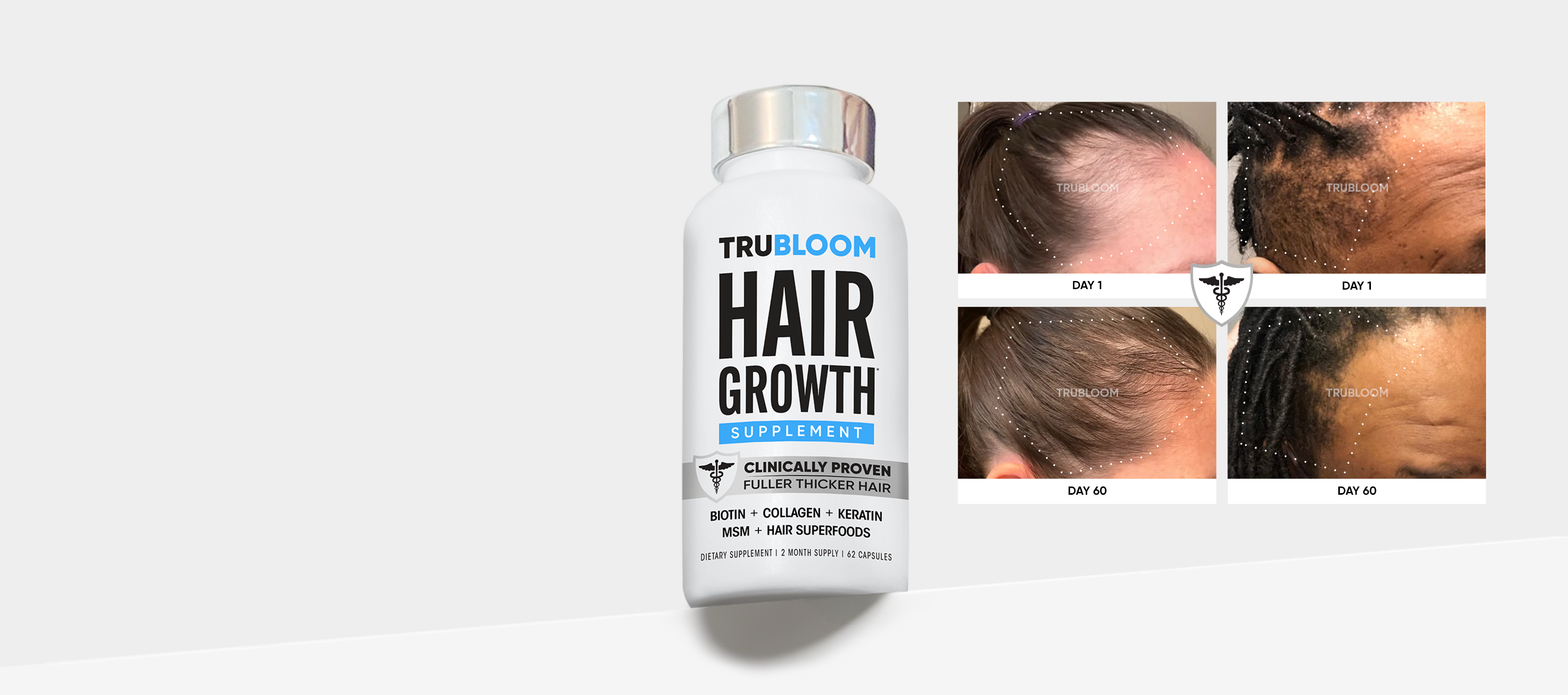 Hair Growth Supplement Bottles