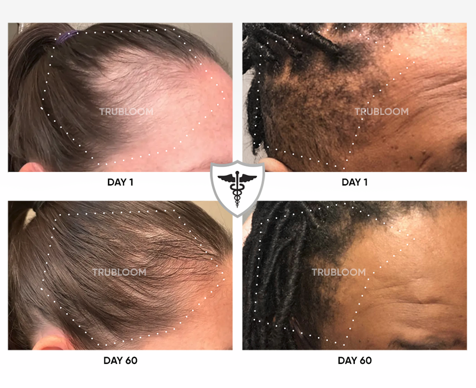 Hair Growth Supplement Bottles